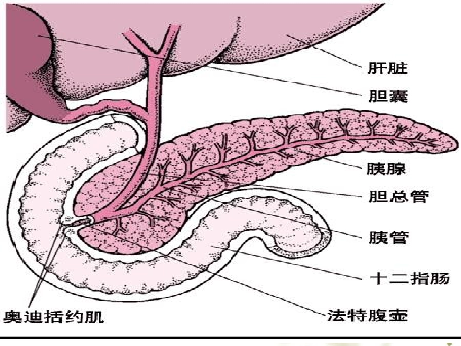 急性胰腺炎病人的护理1_第3页