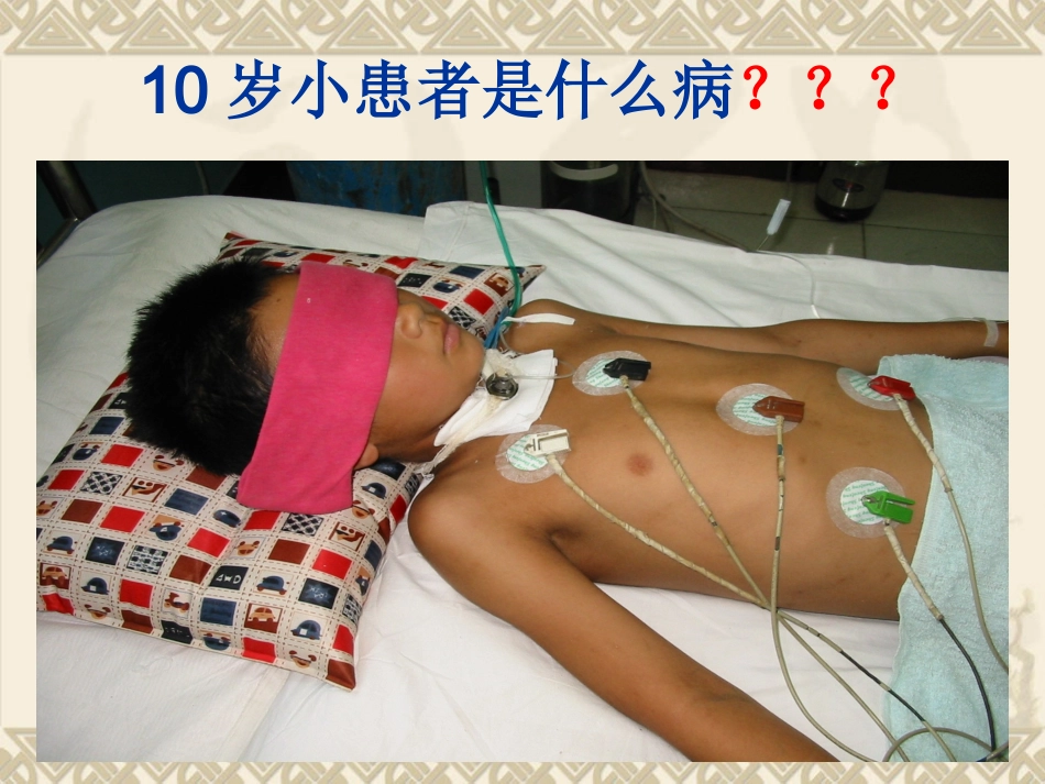 急性炎症性脱髓鞘性多发_第3页