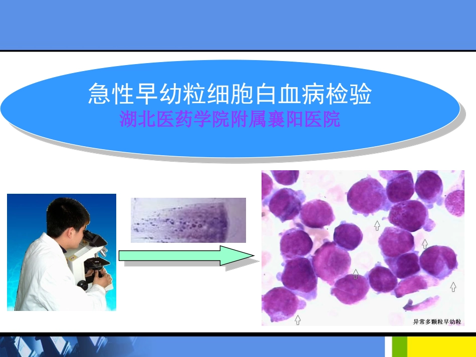 急性早幼粒细胞白血病的检验_第1页