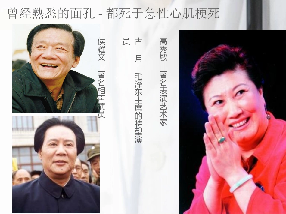 急性心肌梗死科普_第2页