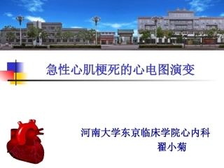 急性心肌梗死的心电图演变