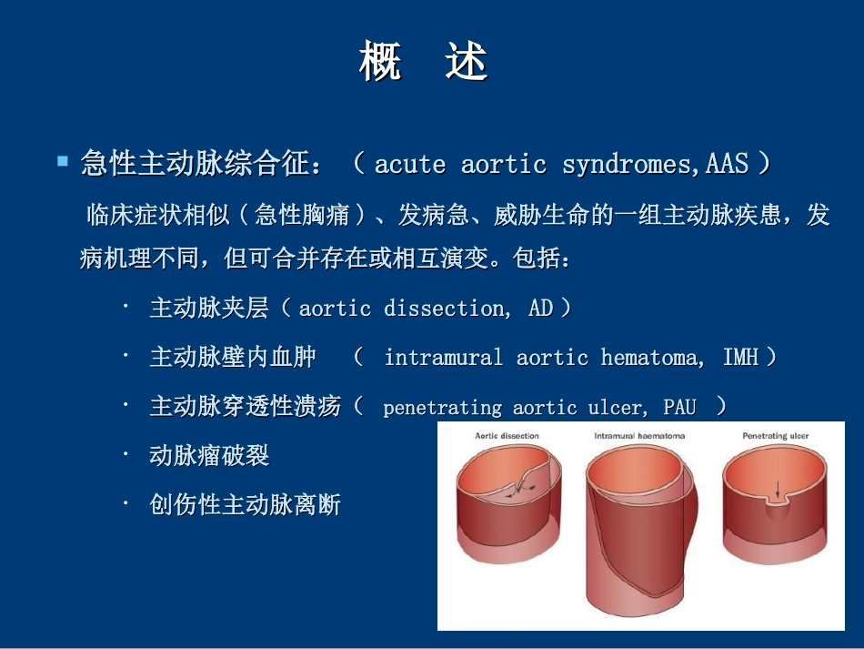 急性主动脉综合征_第2页