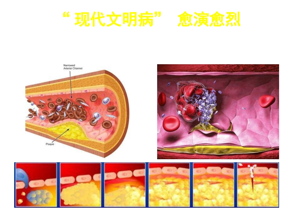 心血管健康讲座_第3页