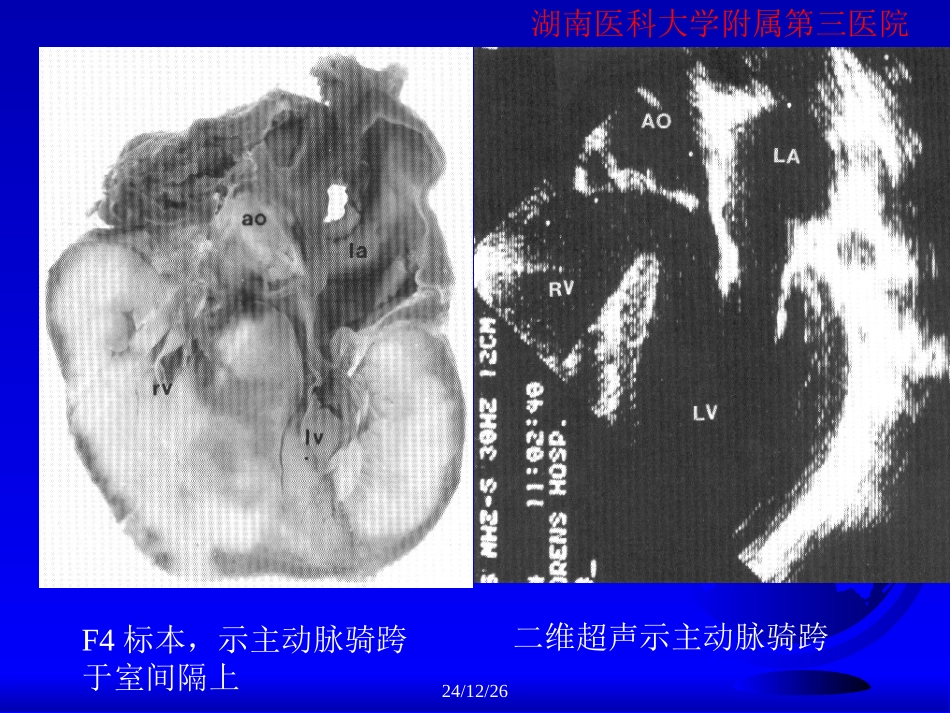 心脏超声检查刘明辉湘雅_第3页