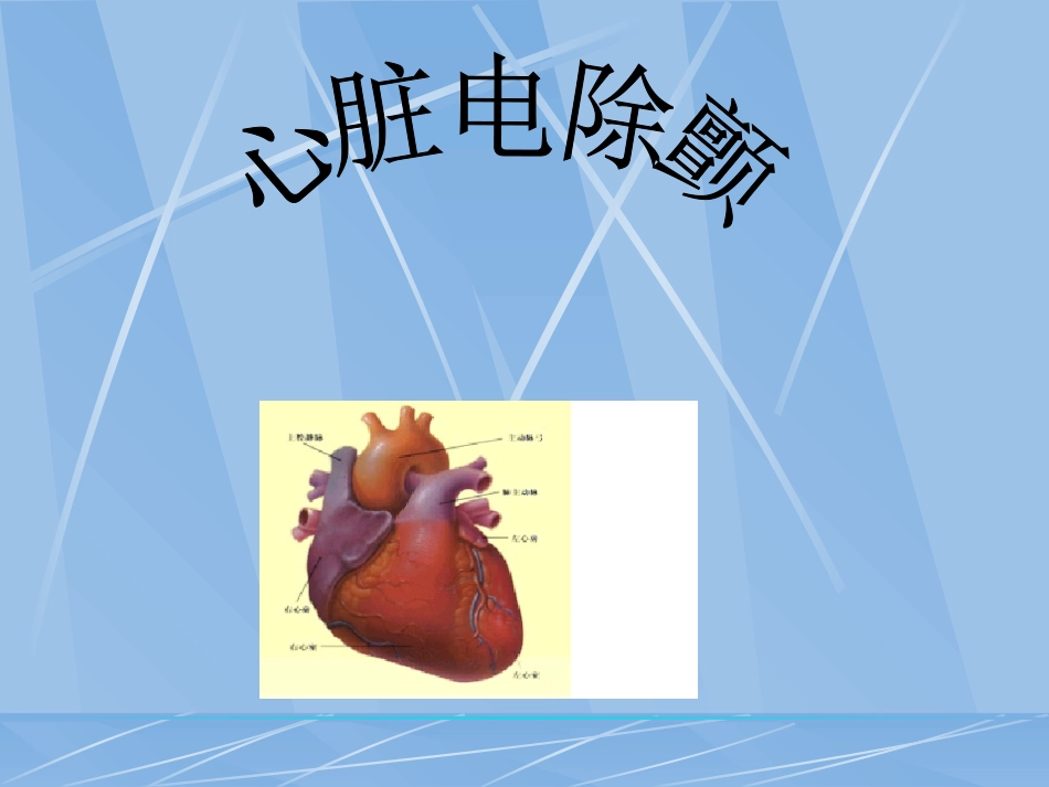 心脏电除颤术_第1页