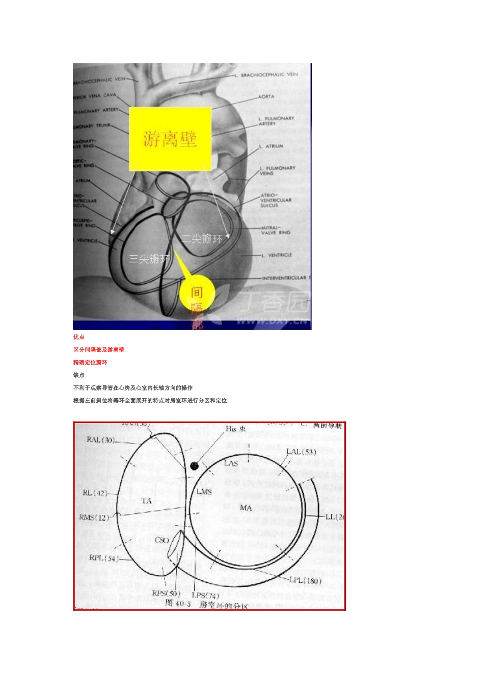 心脏电生理介入扫盲贴_第2页