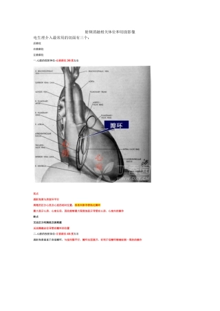 心脏电生理介入扫盲贴