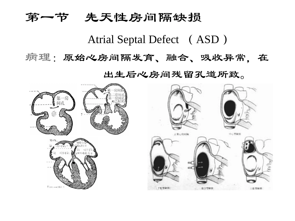 心脏及大血管影像系统8_第3页