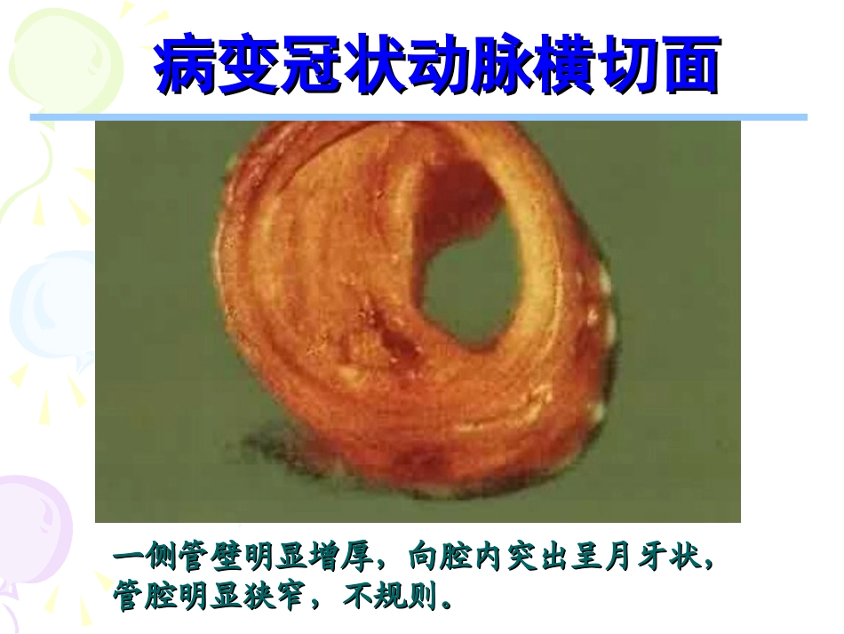 心绞痛、调脂12[整理后]_第3页