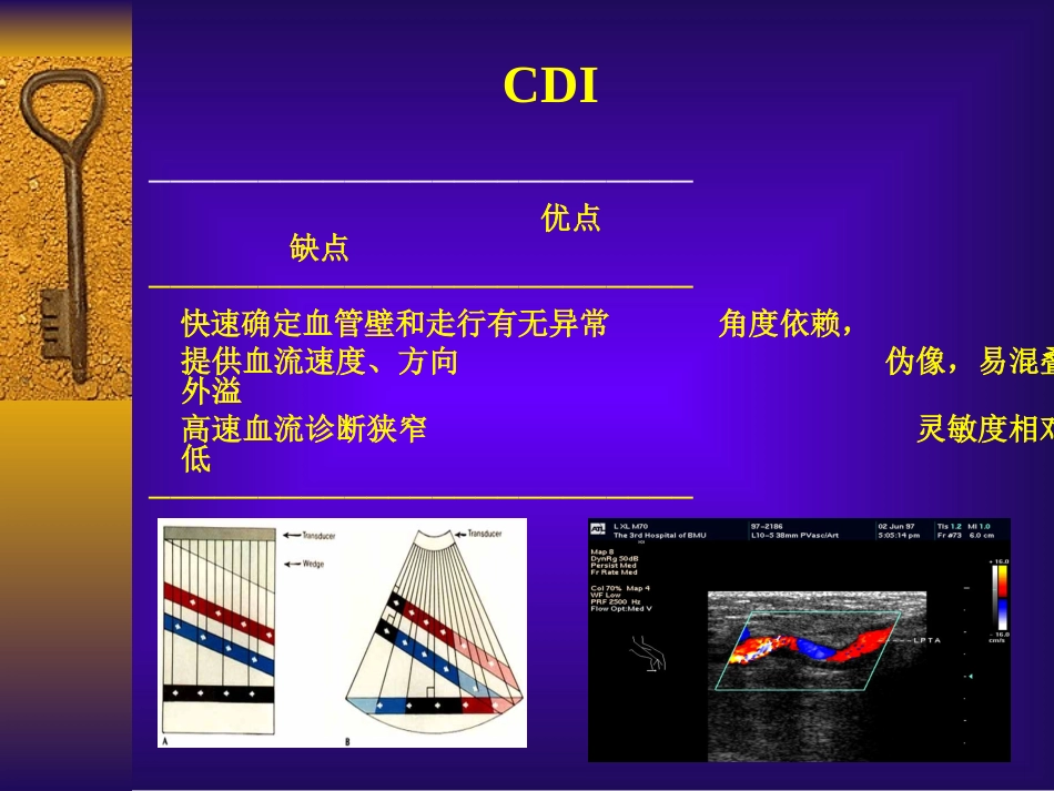 彩色多普勒超声在颈部血管的应用勇强_第2页