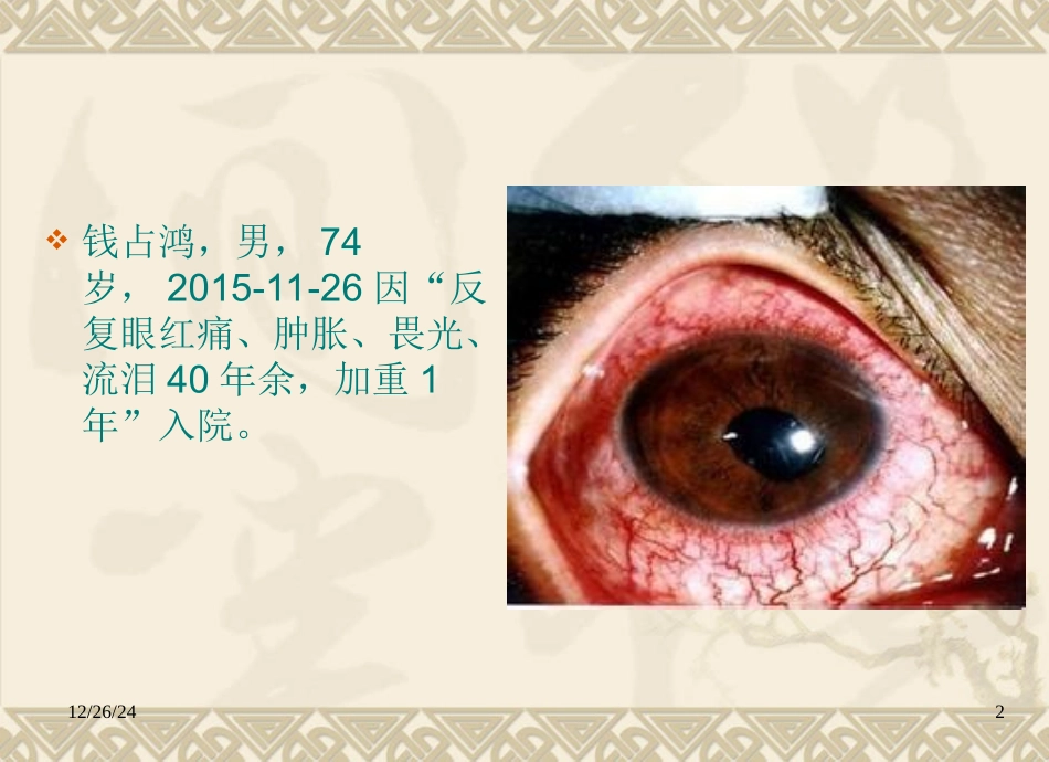 强直性脊柱炎眼部表现病例_第2页