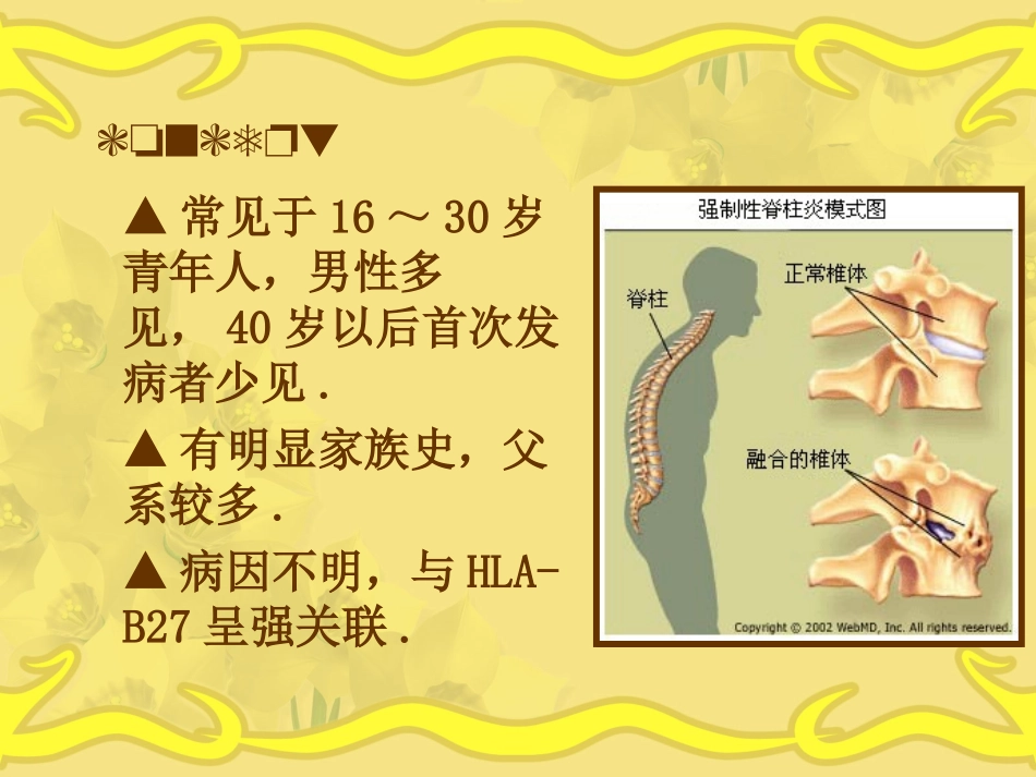 强直性脊柱炎1详解_第3页