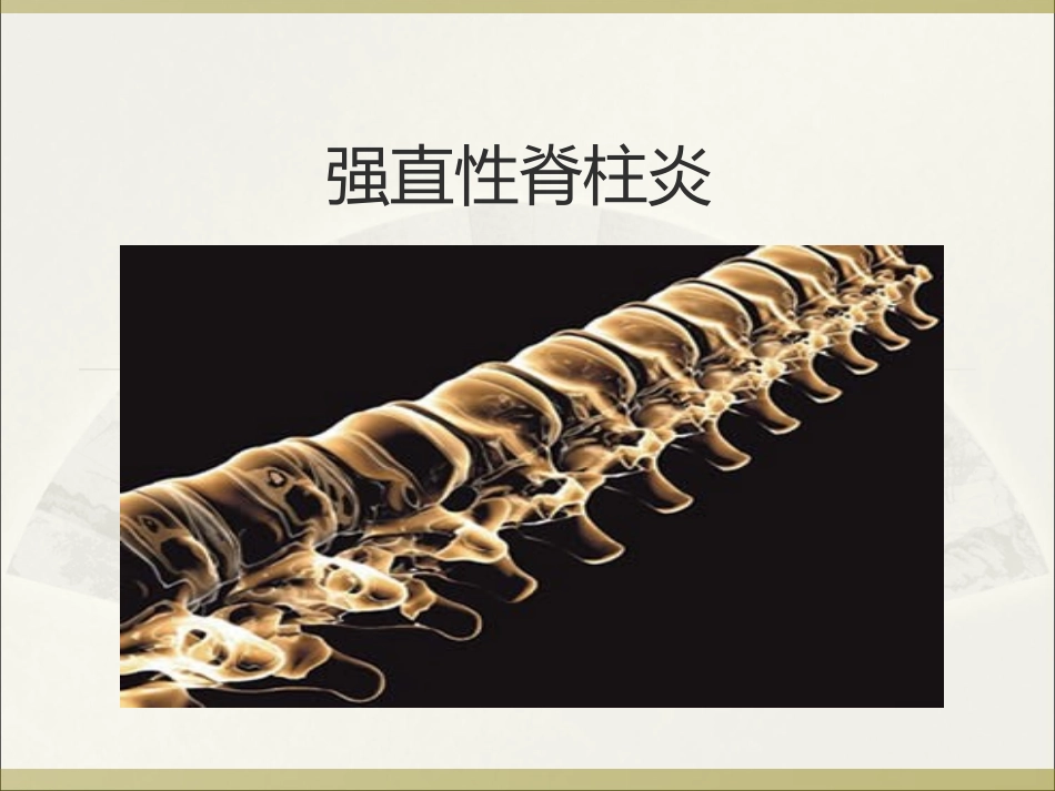 强直性脊柱炎(岩)_第2页
