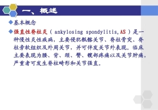 强直性脊柱炎的概述.