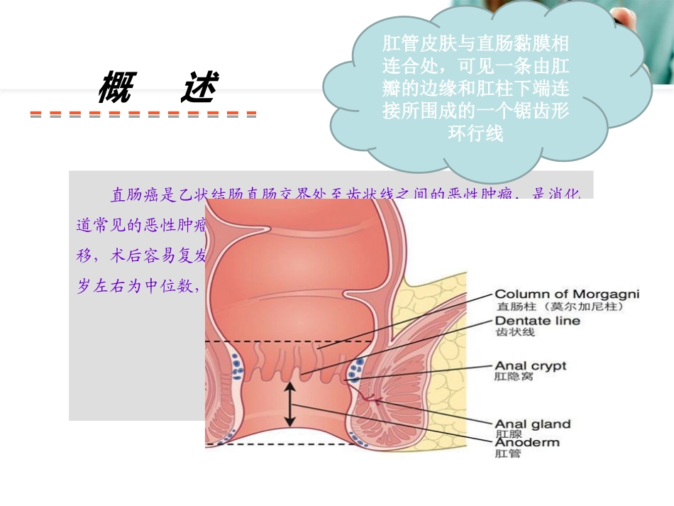 张艳直肠癌的教学查房(1)_第2页