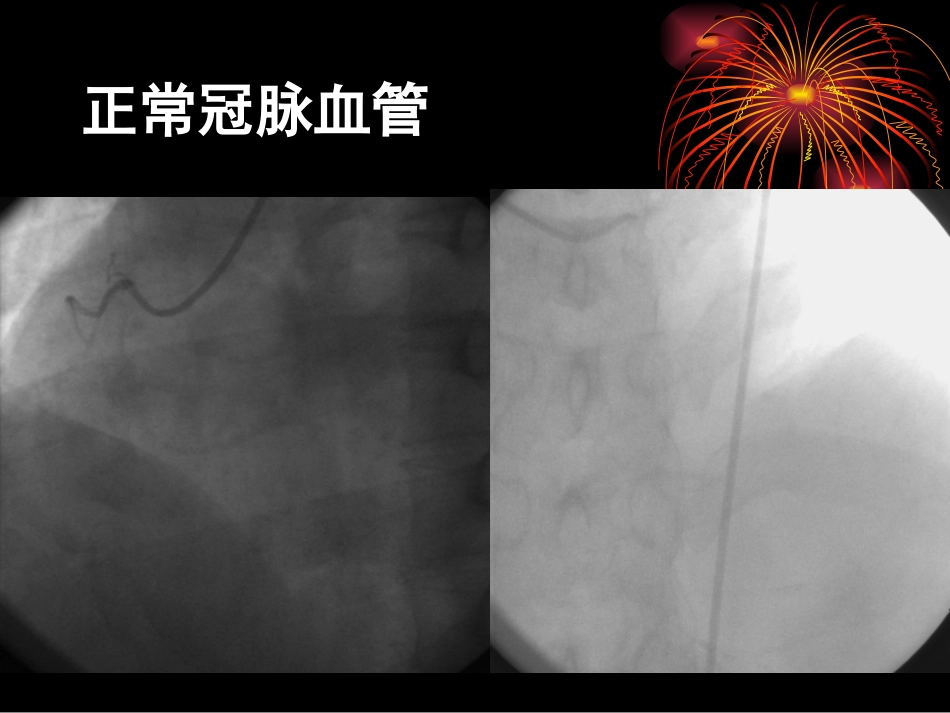 强化血糖控制_第3页