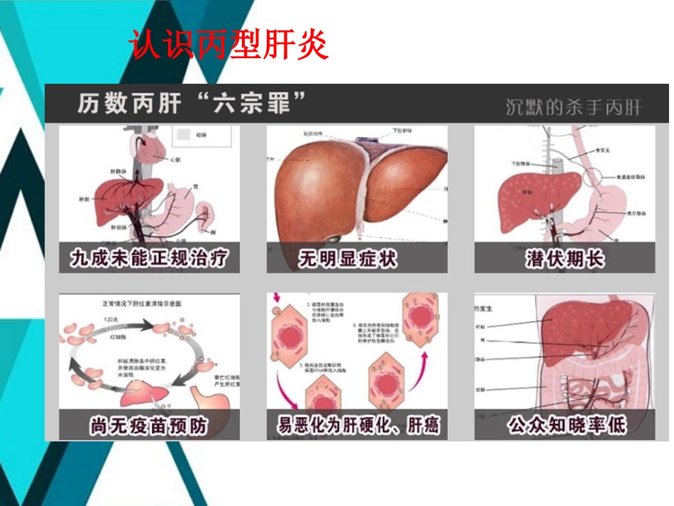 广州丙肝医院讲解如何防治丙型肝炎_第2页