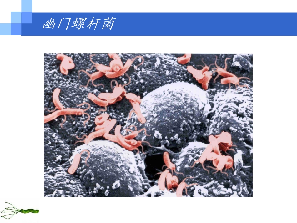 幽门螺杆菌的诊治规范_第1页