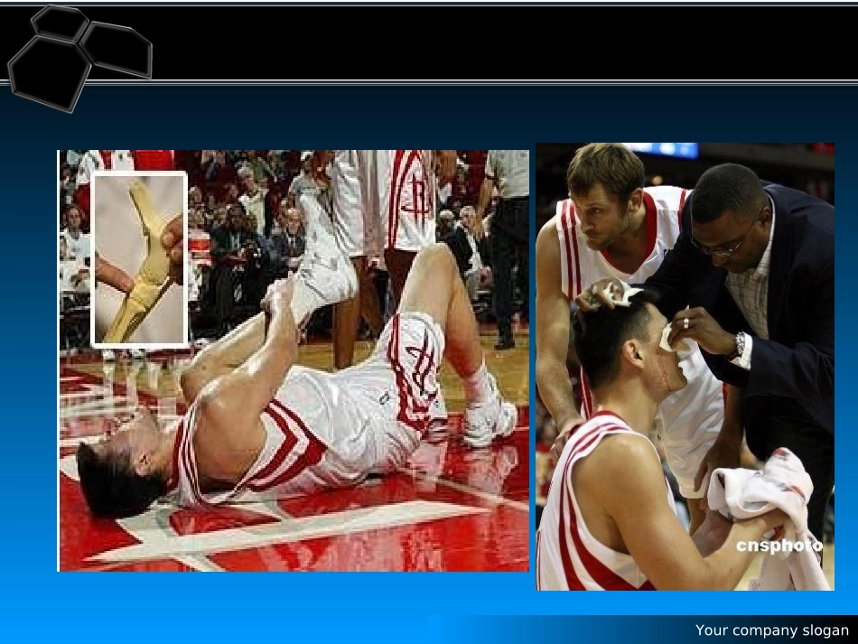 常见运动伤病的自我处理_第3页