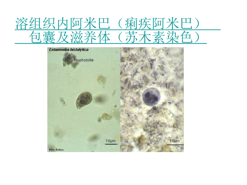 常见寄生虫图谱_第2页