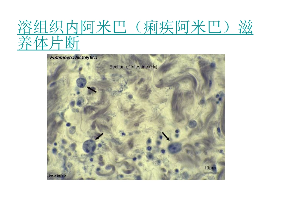 常见寄生虫图谱_第3页