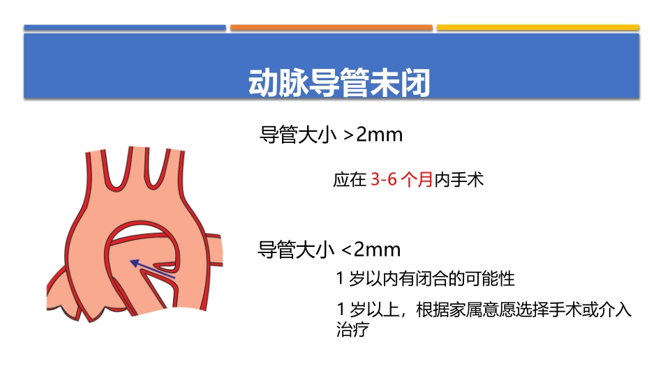 常见先天性心脏病手术时机选择_第3页