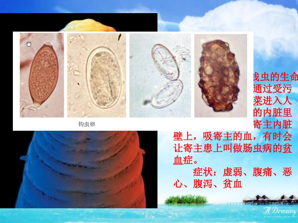 常见人体寄生虫_第2页