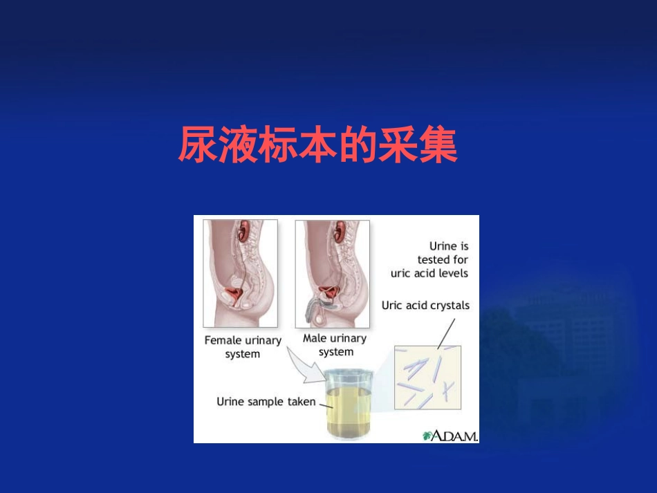 尿液标本与粪便标本的采集与处理_第2页