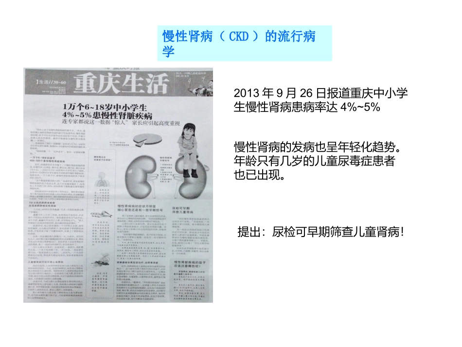 尿微ACR介绍_第3页