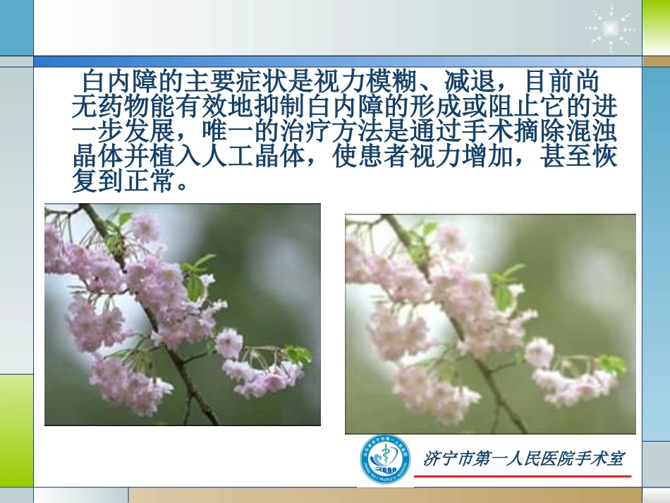 小切口白内障手术1_第2页