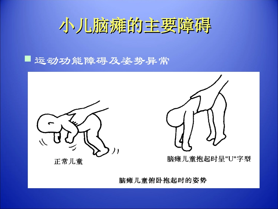 小儿脑瘫康复_第2页