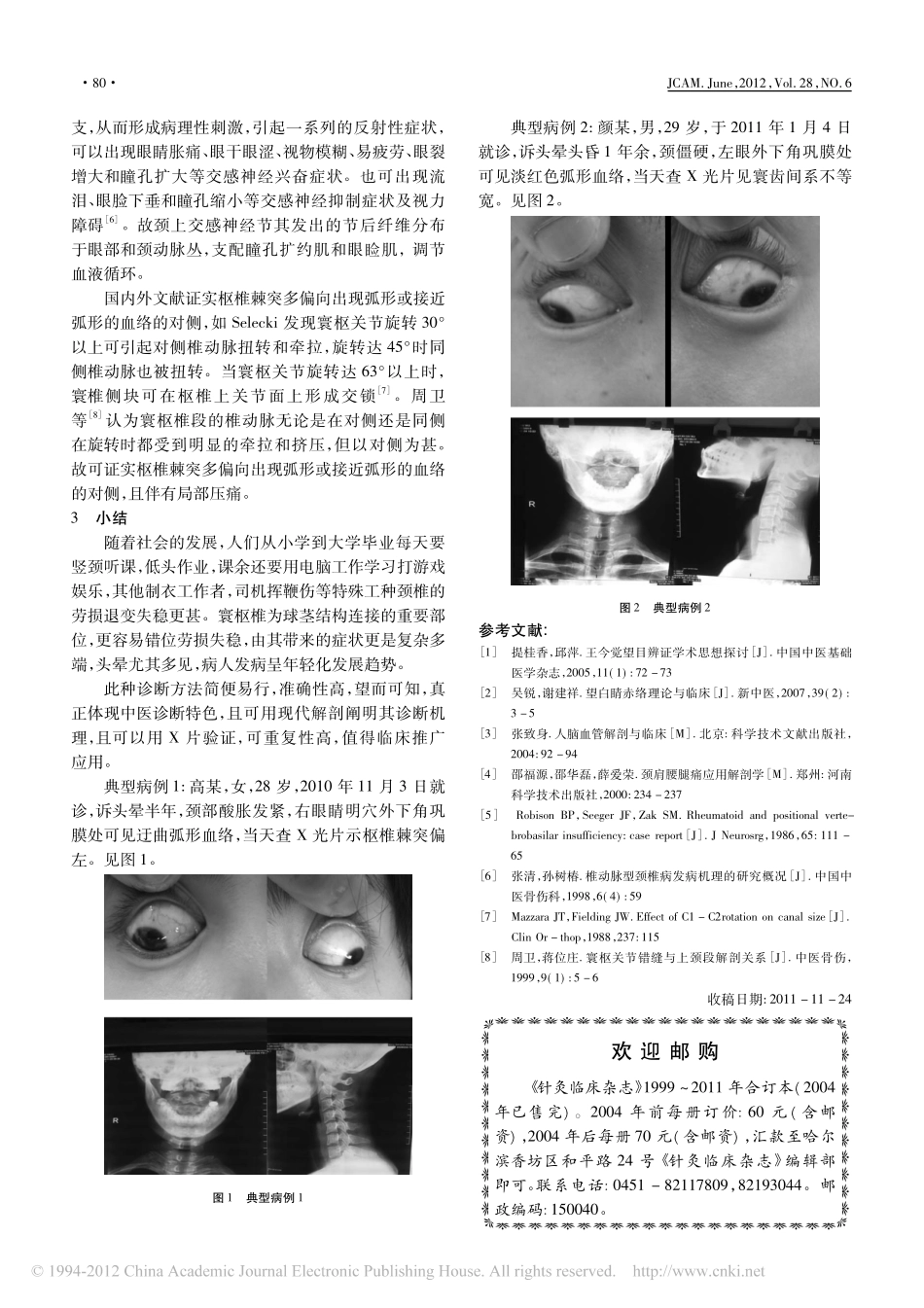 寰枢椎紊乱引起头晕的巩膜眼征机理探讨_第3页