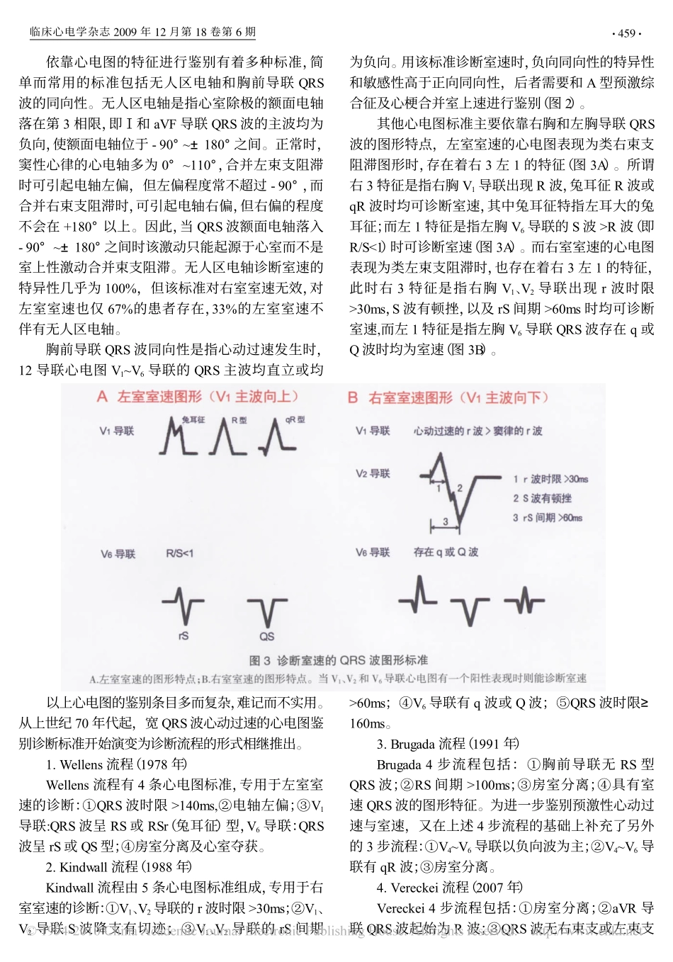 宽QRS波心动过速鉴别诊断新流程(1)_第3页