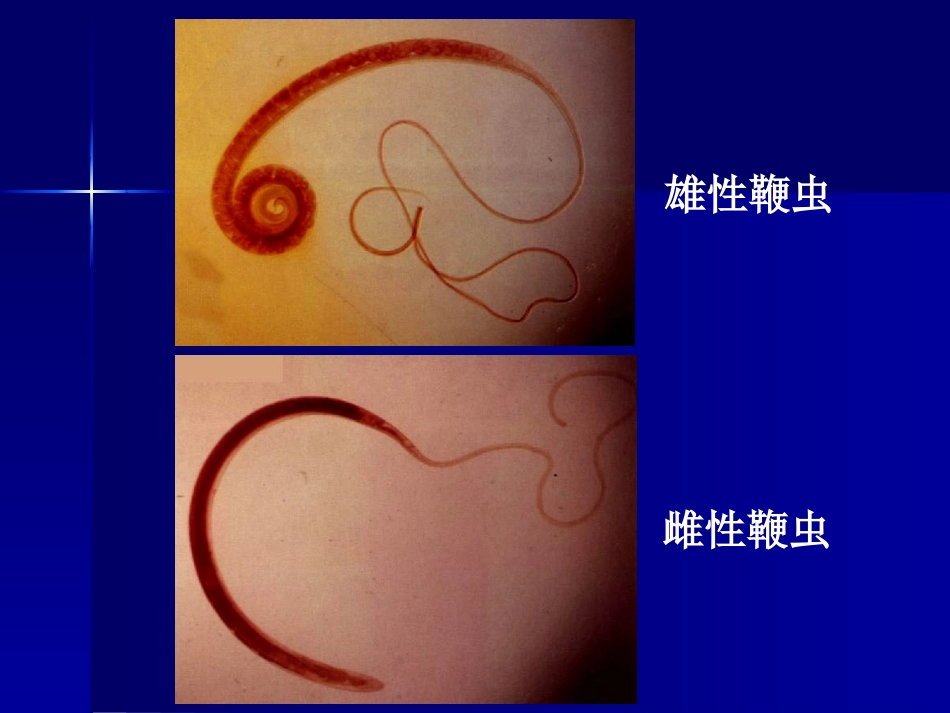 寄生虫-鞭虫_第3页