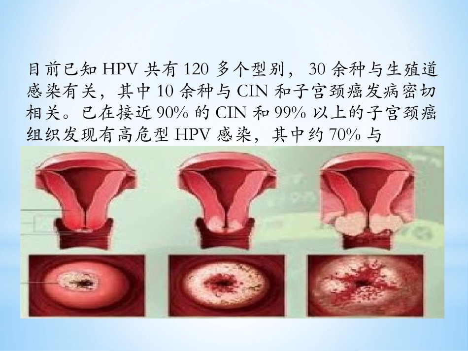 宫颈癌疫苗与HPV_第3页