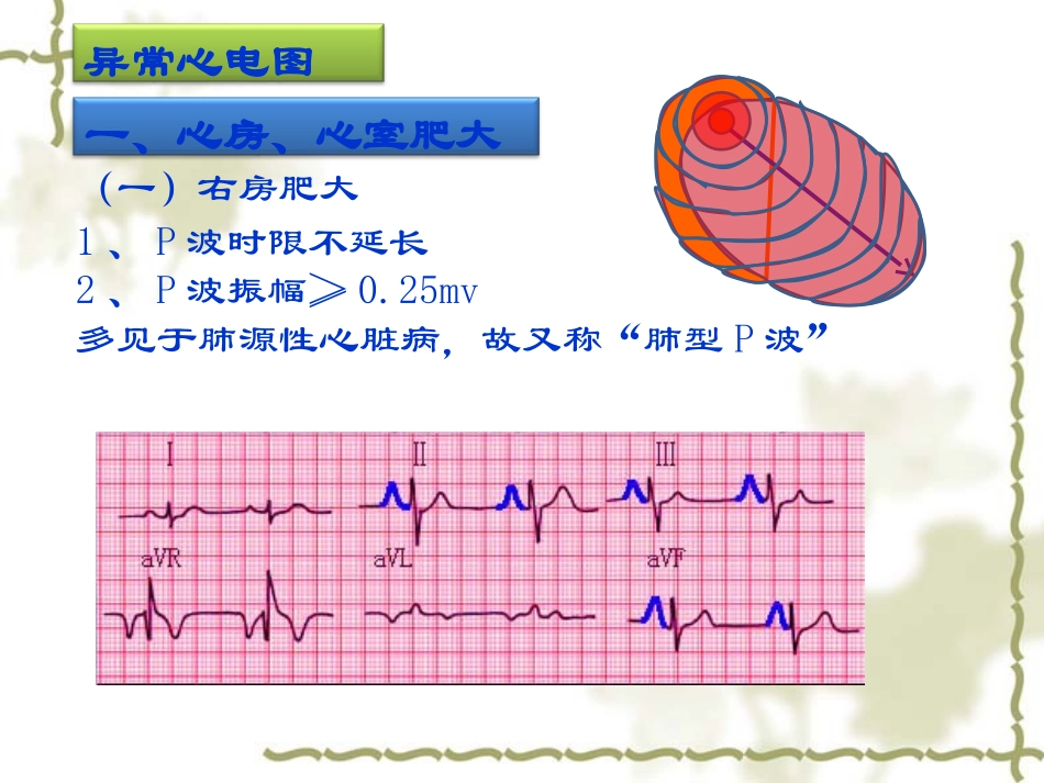 实验诊断学：异常心电图检查_第1页