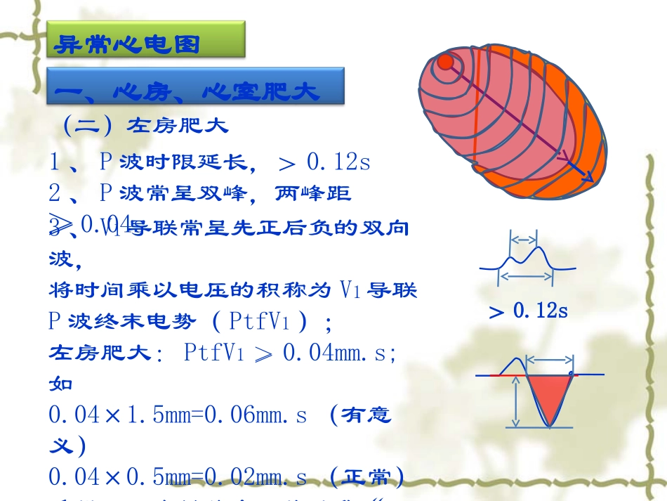 实验诊断学：异常心电图检查_第2页