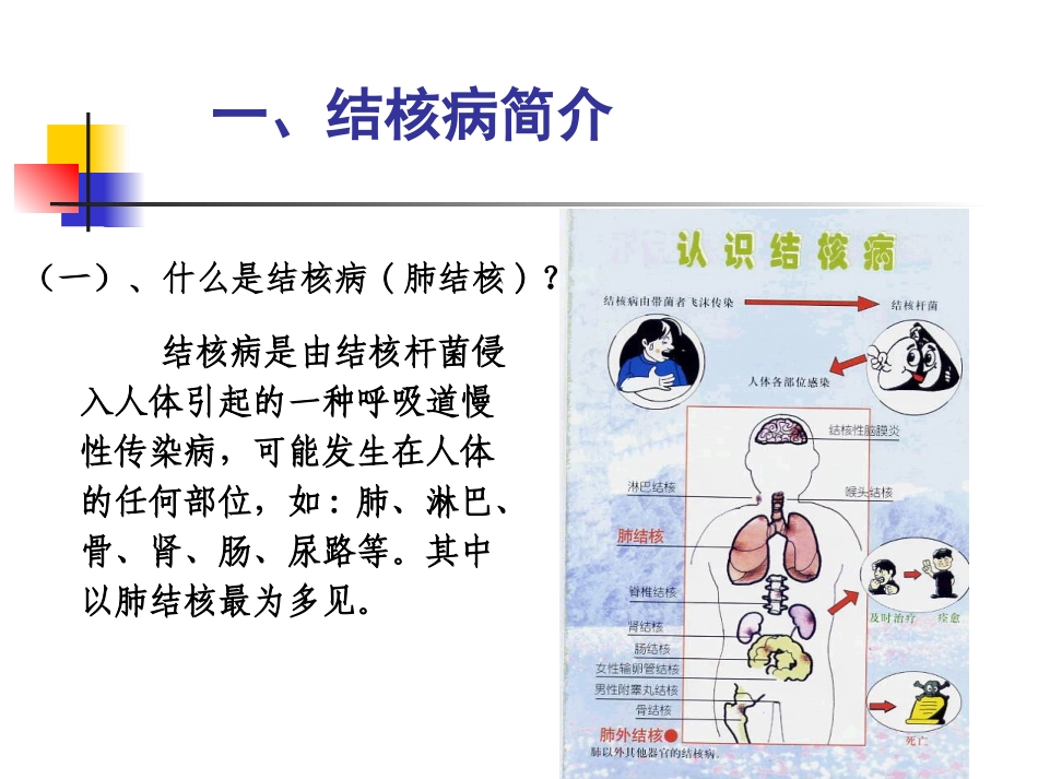 学校结核病(学生)_第2页