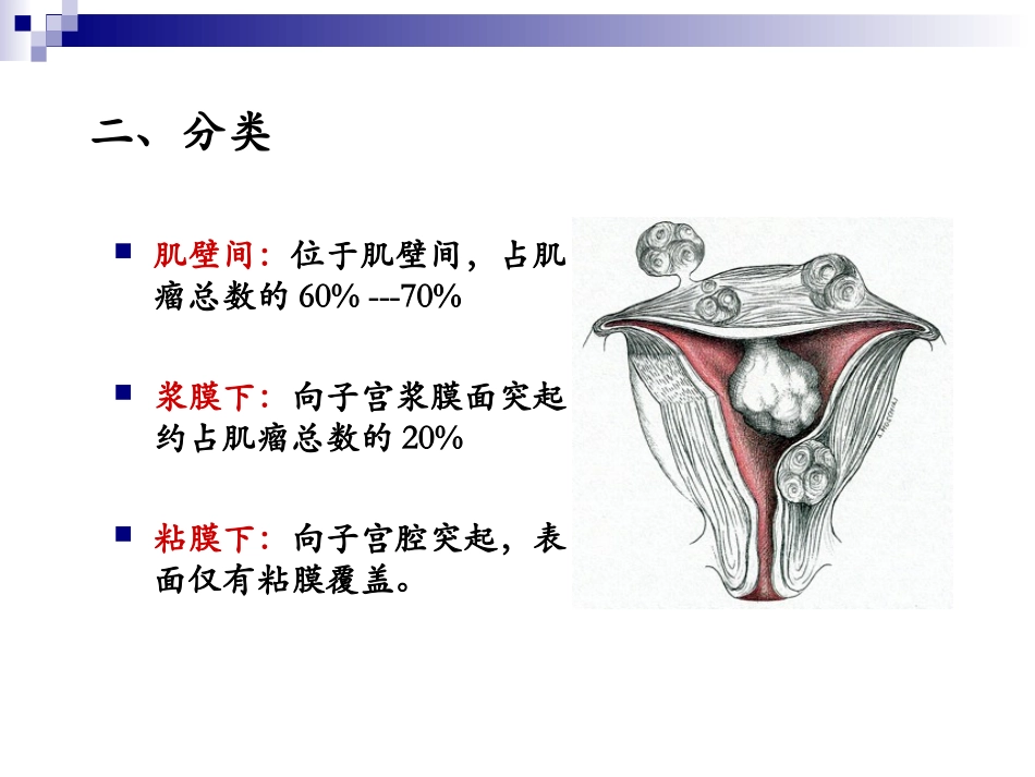 子宫肌瘤和子宫颈癌_第3页