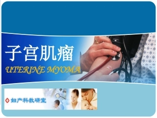 子宫肌瘤知识概述
