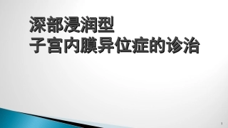 子宫内膜异位