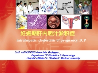 妊娠期肝内胆汁淤积症.ppt1