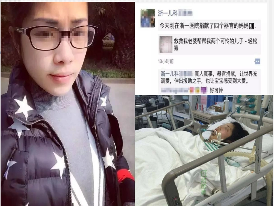妊娠期急性脂肪肝-2016年_第2页