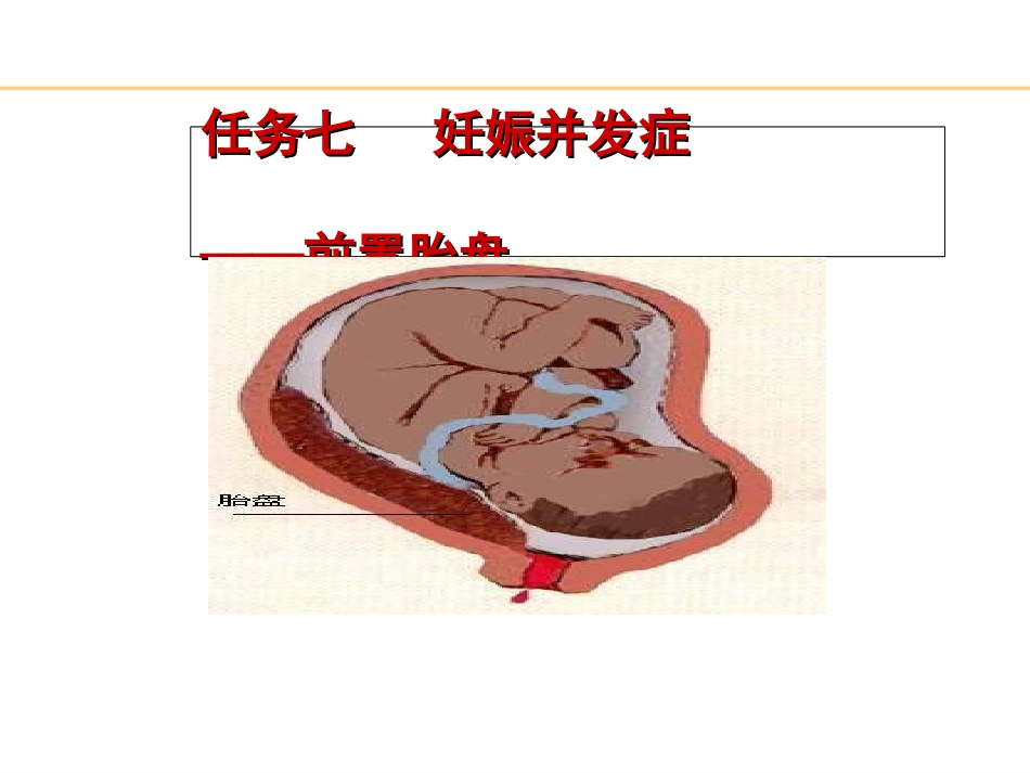 妊娠并发症之前置胎盘_第2页