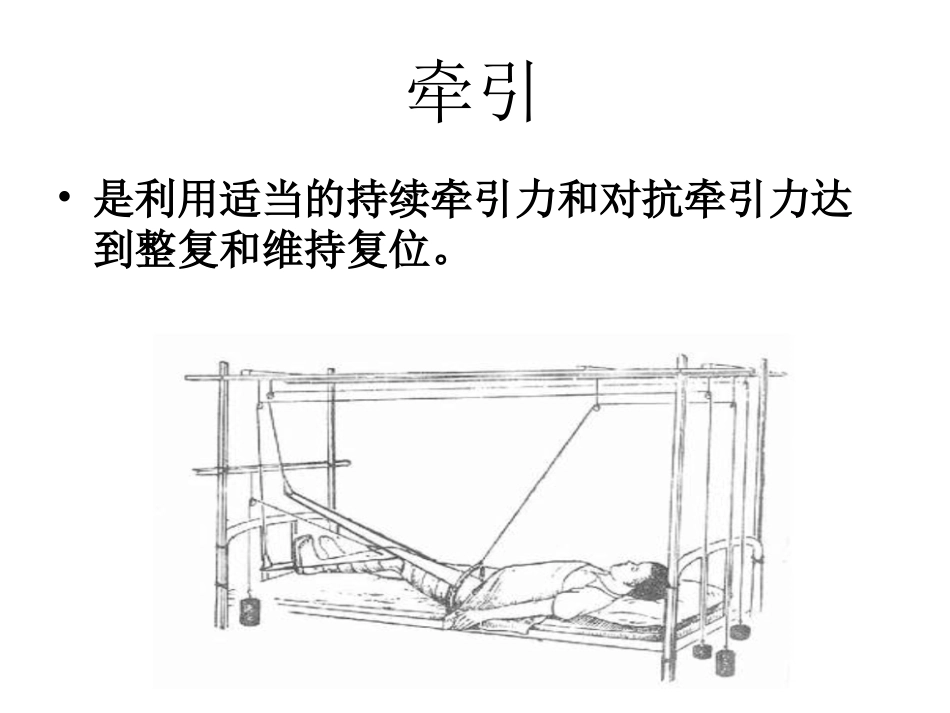 如小儿股骨干骨折用垂直悬吊皮牵引_第1页