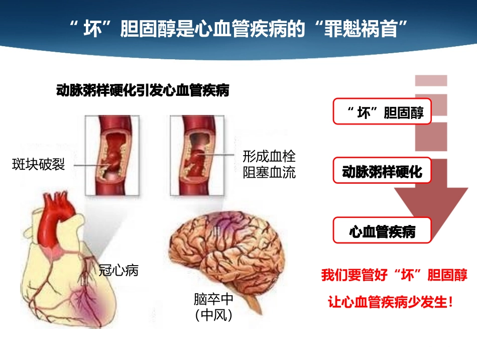 如何降低“坏”胆固醇？_第3页