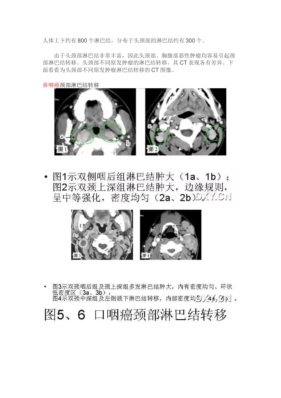 头颈部淋巴结肿大的诊断要点_第1页
