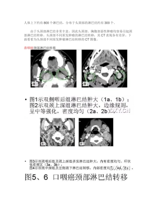 头颈部淋巴结肿大的诊断要点