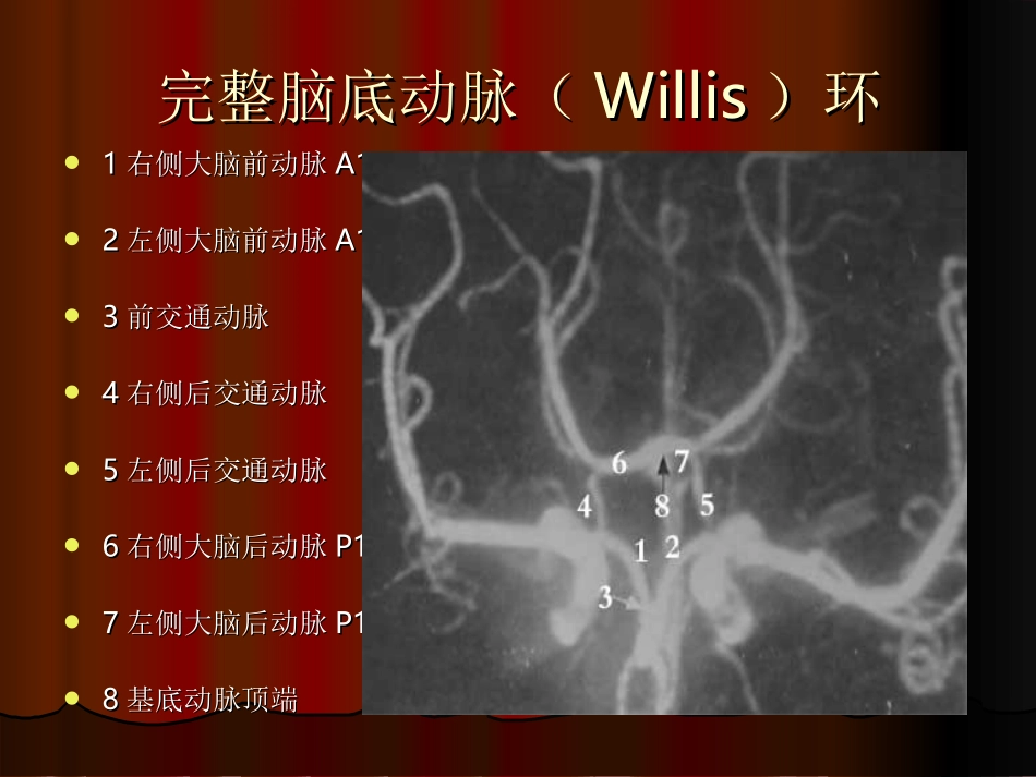 大脑前动脉动脉瘤-用_第3页