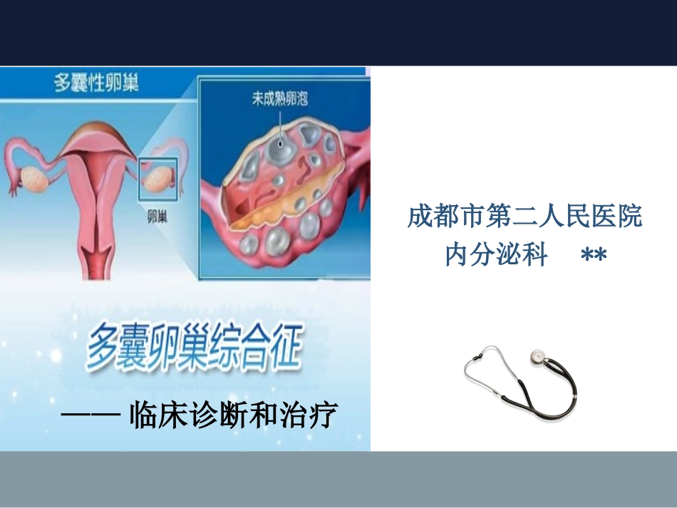多囊卵巢综合征_第1页